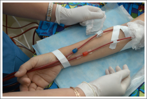 Dialysis Treatment